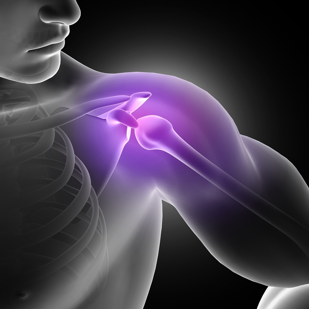 Shoulder Joint Replacement